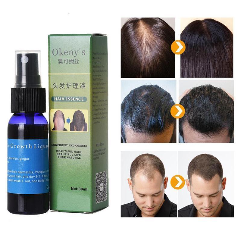 Sunburst Hair Growth Products for women&men anti hair loss products Alopecia Baldness beard oil growth Hair growth spray - Lootquake