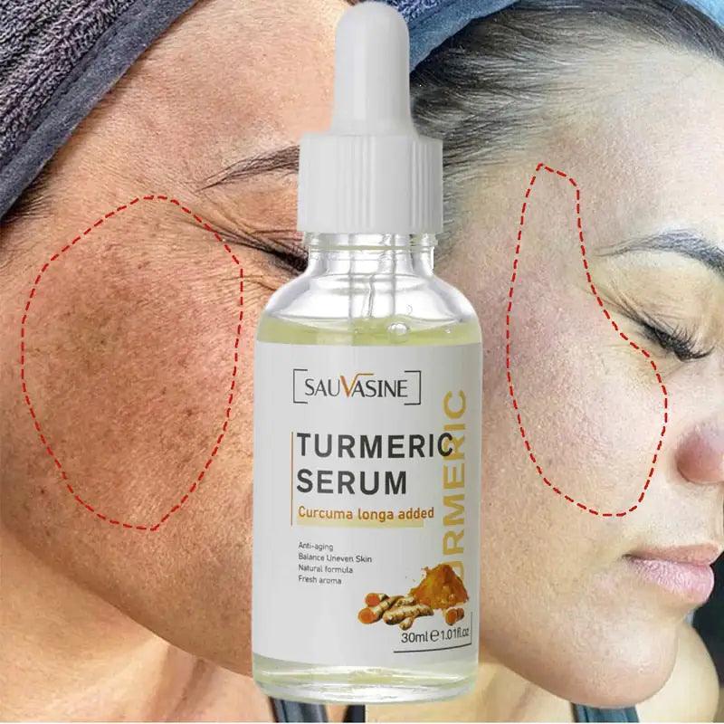 BrightGlow Turmeric Radiance Serum - Unleash Your Skin's Natural Glow