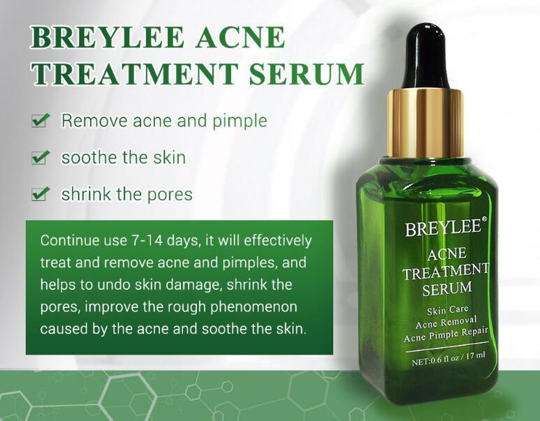 Acne Treatment Serum Facial Repair Oil - Lootquake