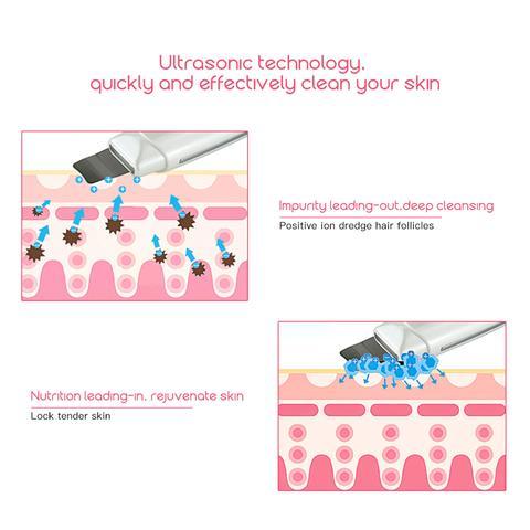 Ultrasonic Skin Scrubber Blackhead Removal