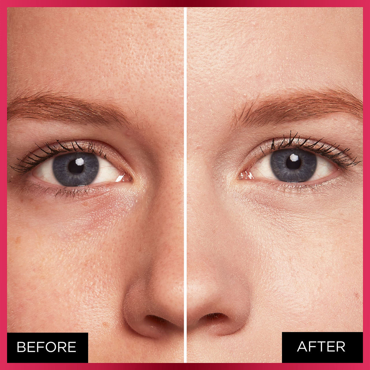 THE CREME SHOP What Acne? Full Coverage Rescue Concealer