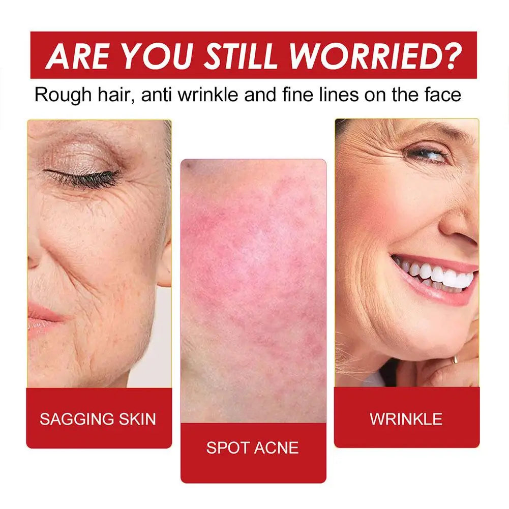 Suero de rosa mosqueta EELHOE