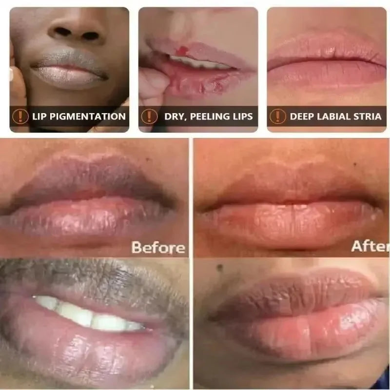 Bálsamo labial para eliminar las ojeras, aclarador de melanina, mascarilla, brillo, exfoliante, tratamiento labial rosa, reduce las líneas de expresión, mejora la sequedad y humecta.
