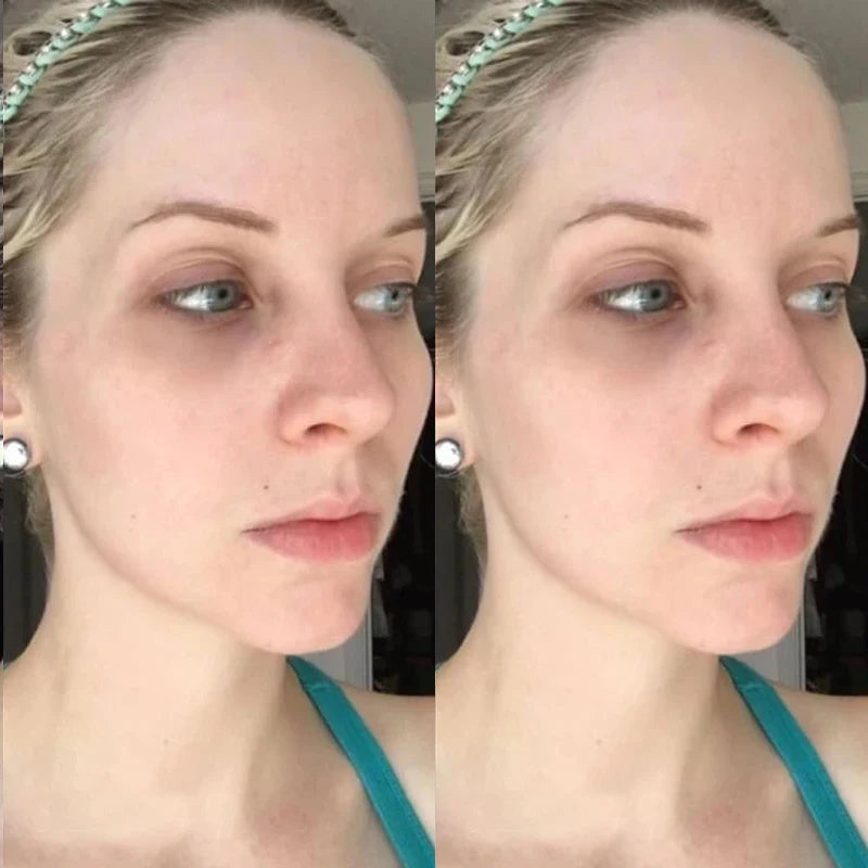 Kit de mascarilla de 6 viales de péptidos de colágeno en polvo liofilizado de Corea, reafirmante facial, hidratante, rejuvenecedor, cuidado de la piel, belleza.