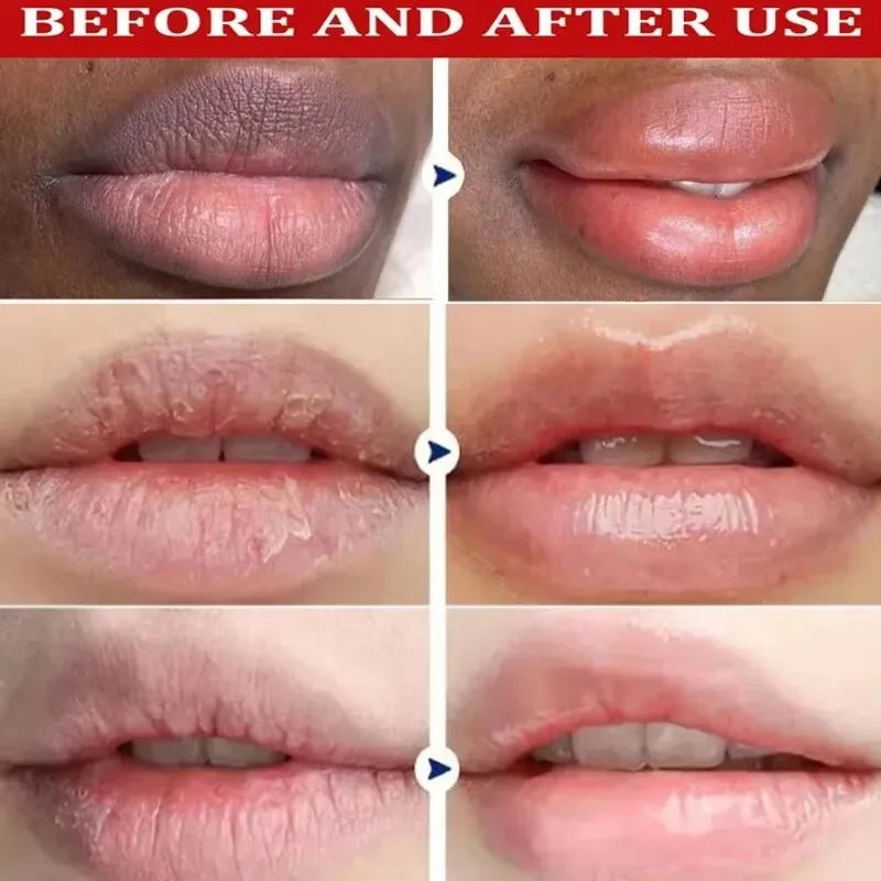 Bálsamo labial para eliminar las ojeras, aclarador de melanina, mascarilla, brillo, exfoliante, tratamiento labial rosa, reduce las líneas de expresión, mejora la sequedad y humecta.