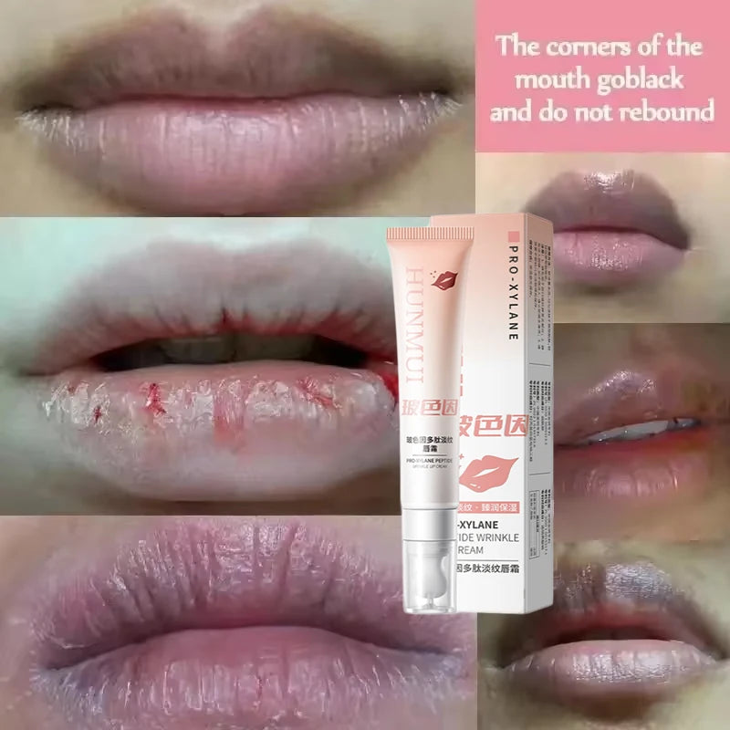 Lip Balm For Remove Dark Lip Moisturizing Lightening Melanin Whitening Plumper Extreme Gloss Pink Lips Skin Care For Men Women