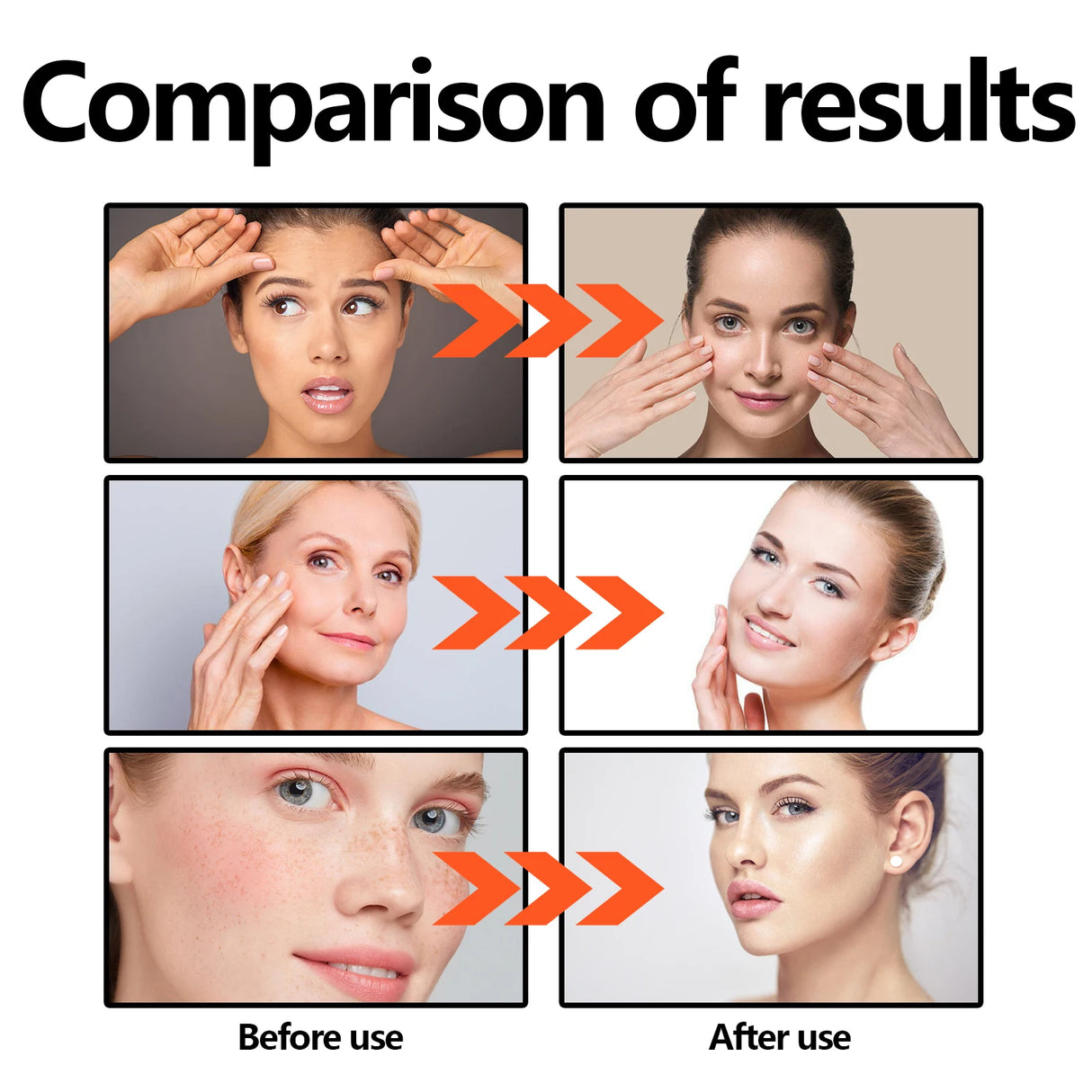 Suero facial con vitamina C (30 ml), iluminador, antiedad, reafirmante, minimiza los poros, esencia hidratante y reafirmante para líneas finas y piel opaca.