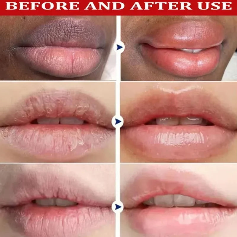 Bálsamo labial con vitamina C para eliminar las ojeras, aclarar la melanina, mascarilla labial, exfoliante, atenuar las líneas de expresión, piel muerta, hidratar, iluminar, reparar, cuidado labial.