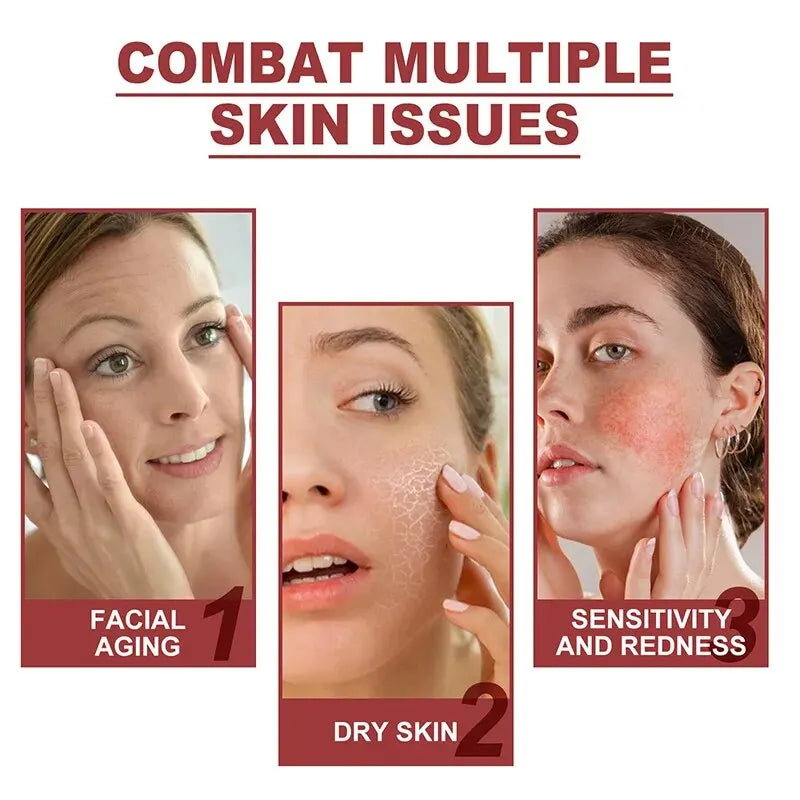 Membrana de colágeno que aclara arrugas, bolsas y ojeras, reafirma la piel y rejuvenece los ojos, dándole volumen e hidratación.