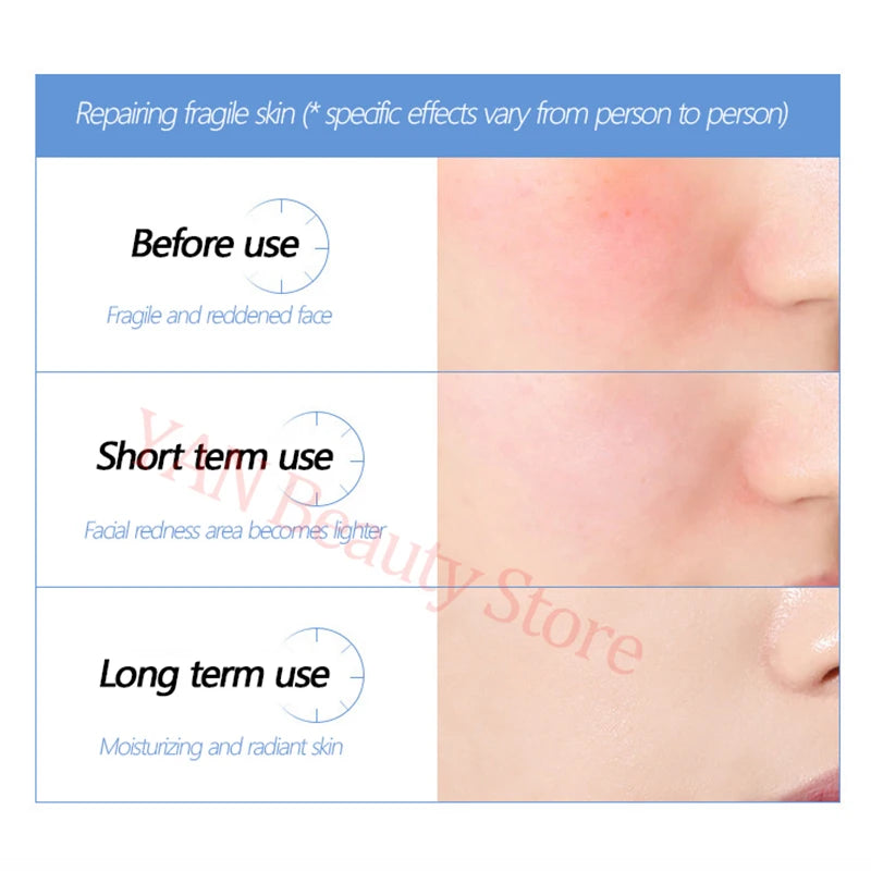 Set de oligopéptidos antiarrugas en polvo liofilizado, suero nutritivo, reparador de colágeno y reafirmante con ácido hialurónico para el cuidado de la piel.