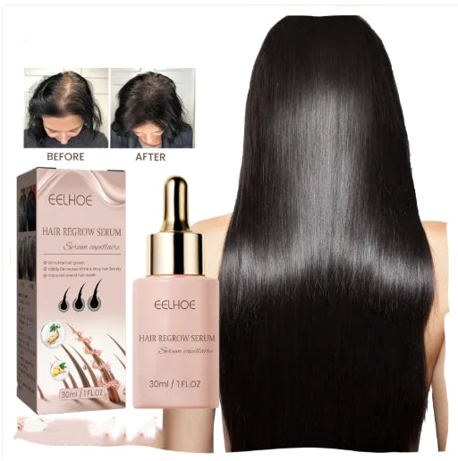 EELHOE Hair Dense Essence Hair Anti-hair Loss And Hair Fixation Nutrition - Lootquake