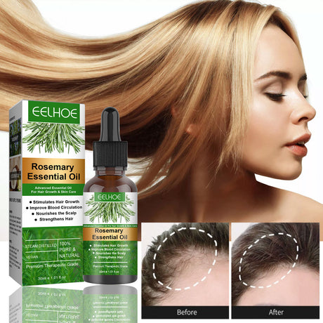 Rosemary Anti-Breakage Nourishing Hair Care Oil - Lootquake
