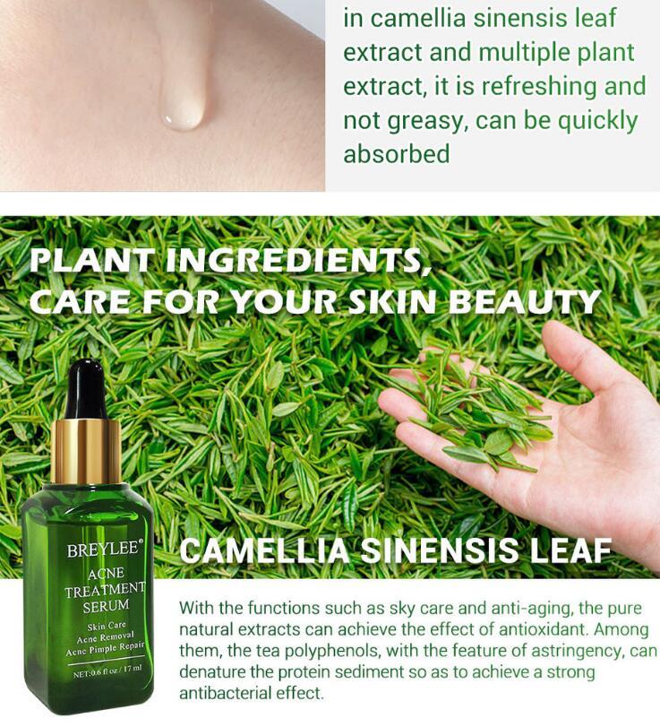 Acne Treatment Serum Facial Repair Oil - Lootquake