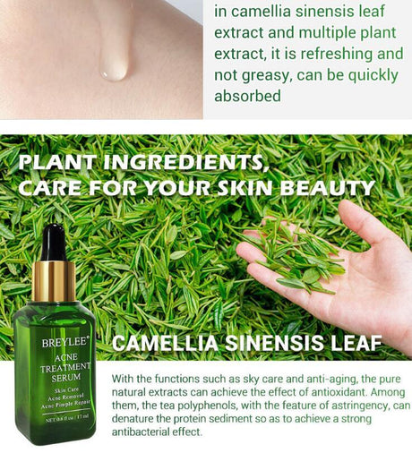 Acne Treatment Serum Facial Repair Oil - Lootquake
