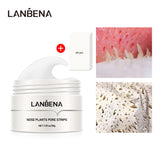 Blackhead Nasal Membrane Sucking Blackhead Tearing To Remove Acne - Lootquake