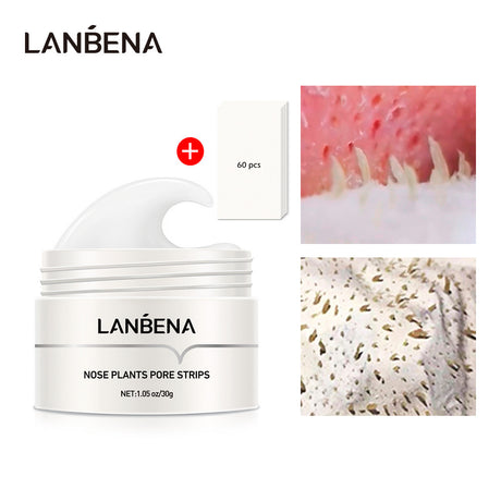 Blackhead Nasal Membrane Sucking Blackhead Tearing To Remove Acne - Lootquake