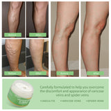 Vein Cream Red Blood Streaks Repair Earthworm Leg Bruises Bulge Relief Pain Safflower Skin care lotion Varicose Cream - Lootquake