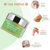 Varicose Vein Relief Cream