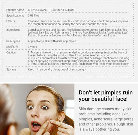 Acne Treatment Serum Facial Repair Oil - Lootquake