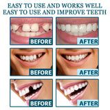 Adjustable Snap-On Dentures: Your Perfect Smile Solution