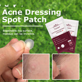 Skin Care Tools Acne Dressing Spot Patch Blemish Treatment Invisible Acne Stickers Pimple Remover Set Face Cream - Lootquake