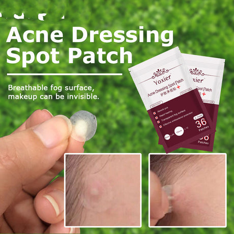 Skin Care Tools Acne Dressing Spot Patch Blemish Treatment Invisible Acne Stickers Pimple Remover Set Face Cream - Lootquake
