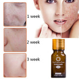 Dredge Meridian Skin Care Natural Pure Removal Acne Stretch Marks Scar Removal Essence oil - Lootquake