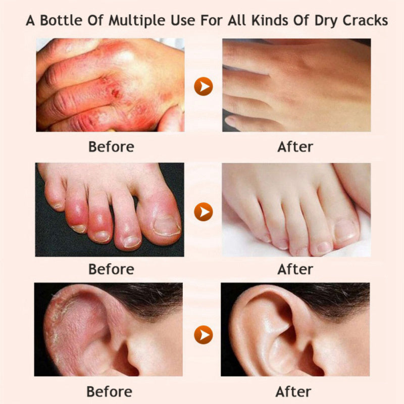 Honey moisturizing cream foot cream leg cream - Lootquake