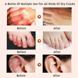 Honey moisturizing cream foot cream leg cream - Lootquake