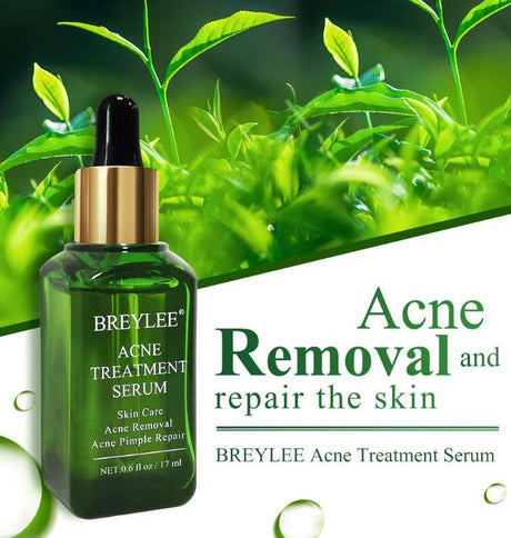Acne Treatment Serum Facial Repair Oil - Lootquake