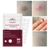 Skin Care Tools Acne Dressing Spot Patch Blemish Treatment Invisible Acne Stickers Pimple Remover Set Face Cream - Lootquake