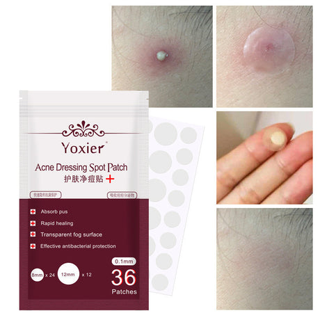 Skin Care Tools Acne Dressing Spot Patch Blemish Treatment Invisible Acne Stickers Pimple Remover Set Face Cream - Lootquake