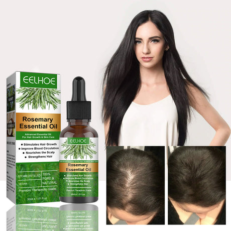 Rosemary Anti-Breakage Nourishing Hair Care Oil - Lootquake