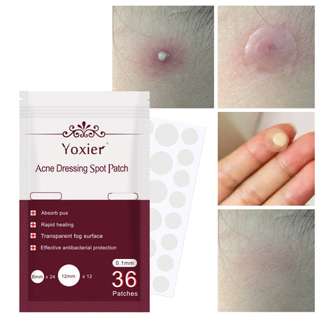 Skin Care Tools Acne Dressing Spot Patch Blemish Treatment Invisible Acne Stickers Pimple Remover Set Face Cream - Lootquake