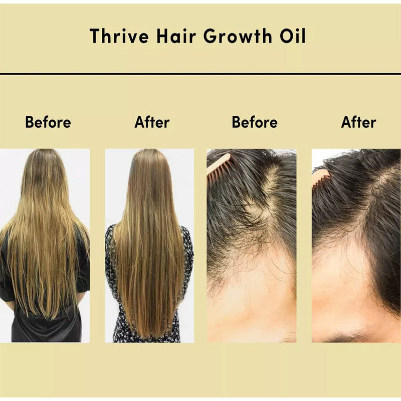 Hair Essential Oil Improve Dryness And Irritability And Nourish - Lootquake