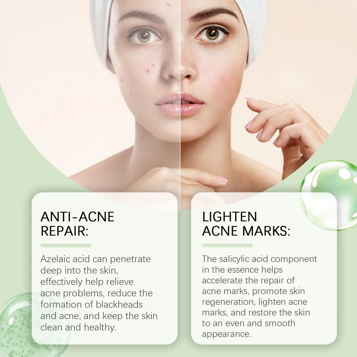 EELHOE Rejuvenating Salicylic Acid Serum-2