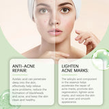 EELHOE Rejuvenating Salicylic Acid Serum-2