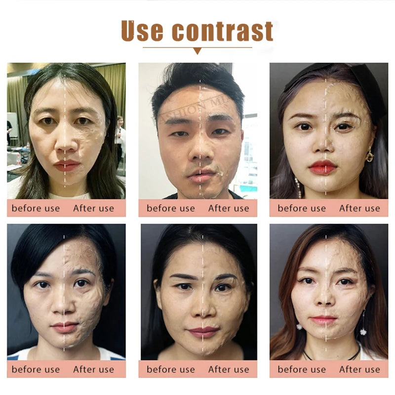 Korea Miracle Witch Facial Mask V-Face Sculpting Lifting Firming Enzyme Mask Face V Shaping Face Sculpture Contouring Mask a