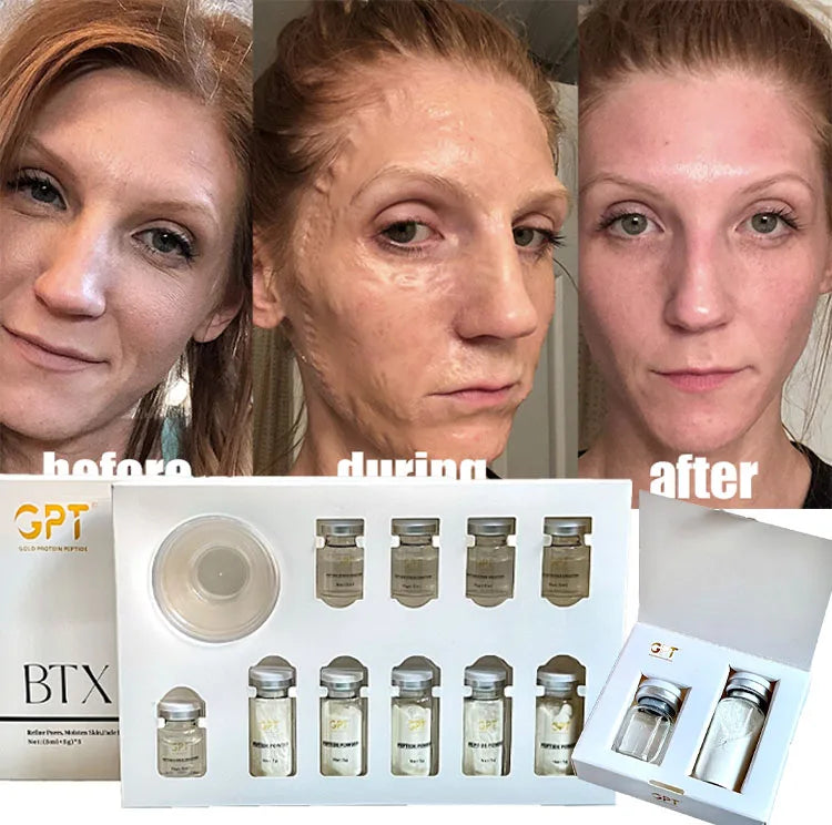 Korea Miracle Witch Facial Mask V-Face Sculpting Lifting Firming Enzyme Mask Face V Shaping Face Sculpture Contouring Mask a
