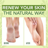 Crema hidratante para pies, para pies y talones secos. Crema calmante para pies secos y agrietados con urea y aceite de árbol de té.