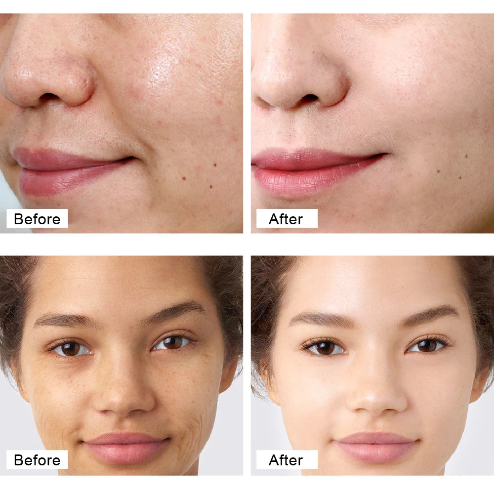 Crema de colágeno con perlas, antiedad, blanqueadora, hidratante, antisequedad, iluminadora, reafirmante y reafirmante, crema facial antiarrugas para el cuidado de la piel.
