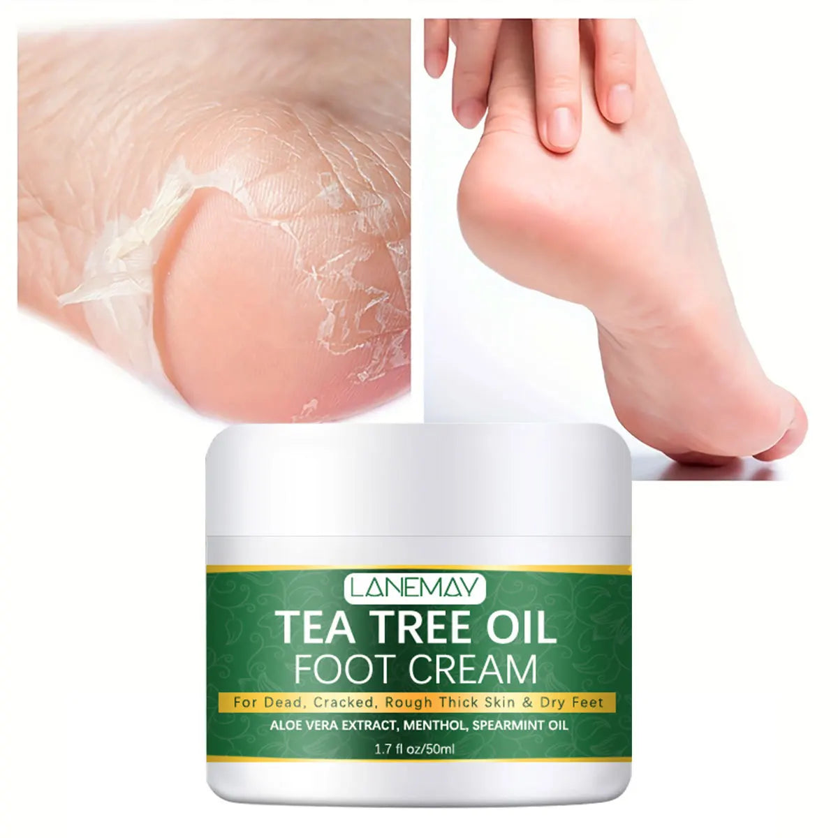 Crema hidratante para pies, para pies y talones secos. Crema calmante para pies secos y agrietados con urea y aceite de árbol de té.