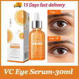 Suero para ojos con vitamina C que elimina las ojeras, atenúa las líneas finas y reduce la hinchazón. Esencia antiedad, reafirma y reafirma el contorno de ojos.