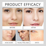 Crema antioxidante con nuez y vitamina C, iluminadora, tonificante, nocturna, correctora de manchas oscuras, hidratante, ligera, de rápida absorción.