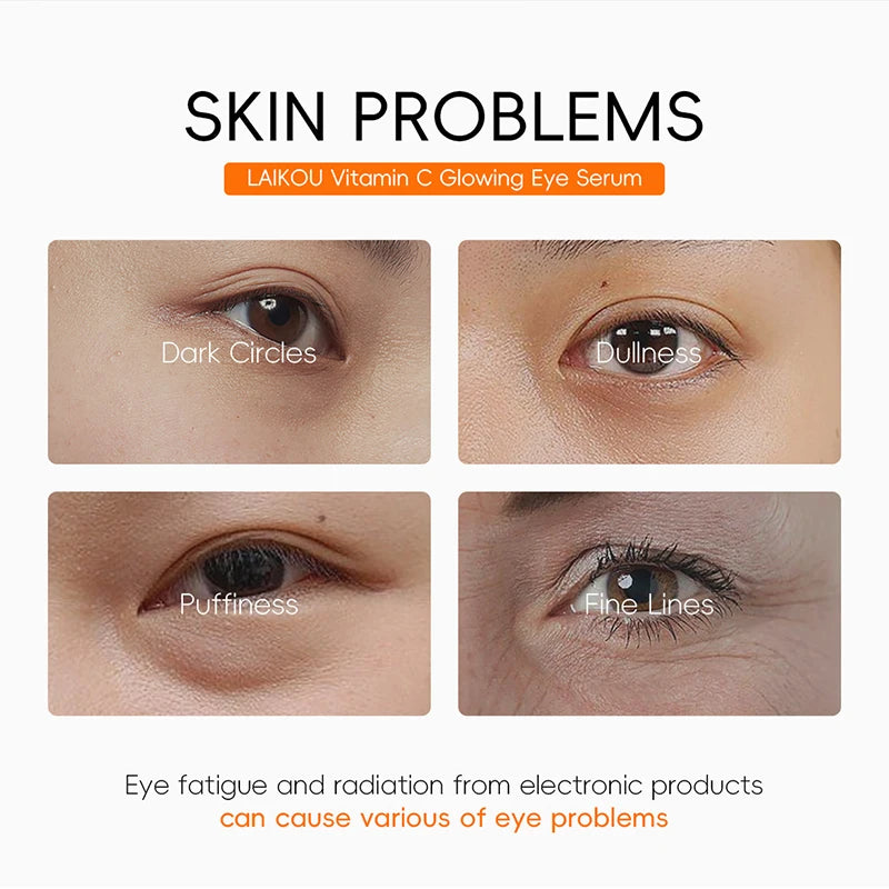 Suero para ojos con vitamina C que elimina las ojeras, atenúa las líneas finas y reduce la hinchazón. Esencia antiedad, reafirma y reafirma el contorno de ojos.