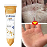 Crema de manos antiarrugas con colágeno, antisequedad, antigrietas, hidratante, nutritiva, suavizante, blanqueadora, reparadora.