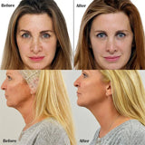 Hilo de colágeno, lifting instantáneo, eliminador de arrugas, suero de proteína soluble, relleno facial absorbible, cuidado de la piel antienvejecimiento. Nuevo.