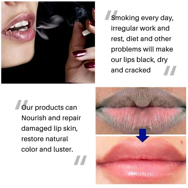 Lip Balm Lightening Remove Dark Lip Gloss Moisturizing Exfoliating Clean Reduces Lip Lines Makeup Beauty Lipstick For Lip Care