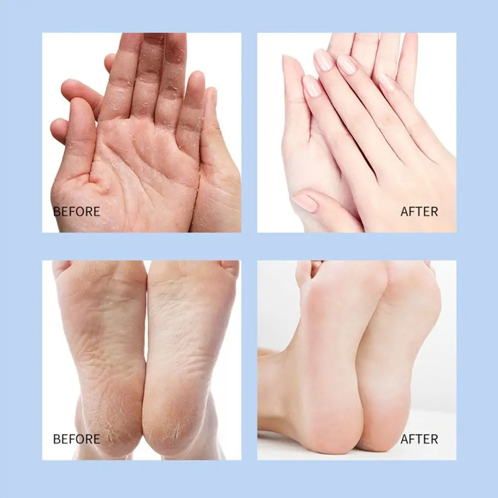 Remobing Dead Skin And Callus Cracked Feet Cream Stick Preventing Cracking Moisturizing Feet Hand Care Cream 40G Hydrating