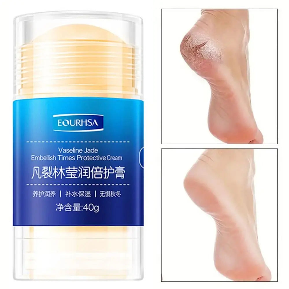 Remobing Dead Skin And Callus Cracked Feet Cream Stick Preventing Cracking Moisturizing Feet Hand Care Cream 40G Hydrating